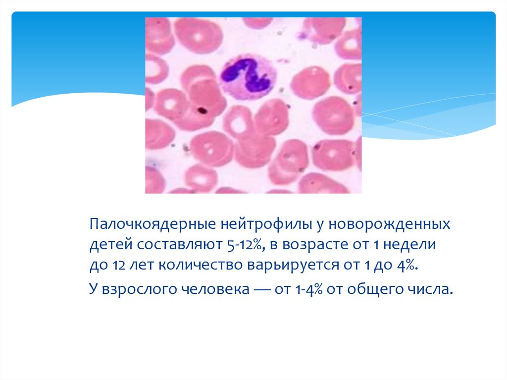 Палочкоядерные нейтрофилы картинки