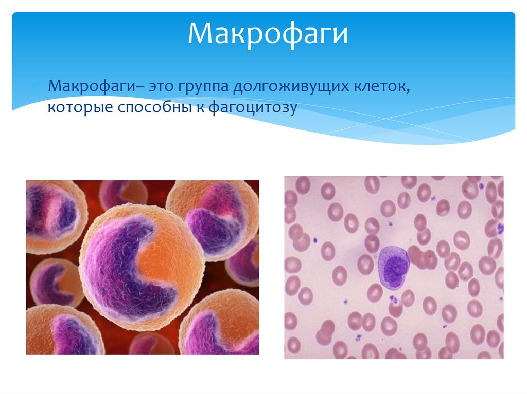 Эритроциты макрофаги. Гранулярные макрофаги. Макрофаги это клетки. Гранулярные лейкоциты макрофаги. Макрофаги в крови.