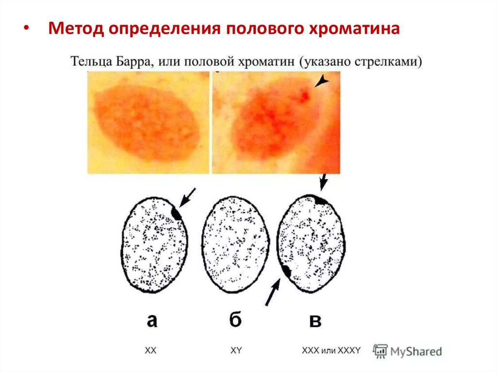 Рисунок тельца барра