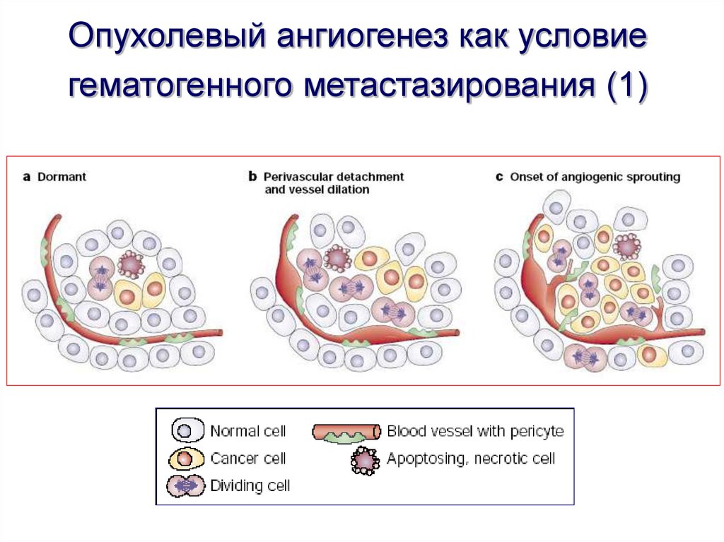 Подпишите картинки виды опухолевого роста