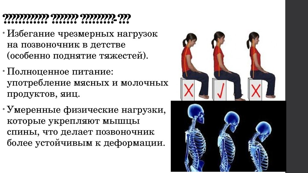 Болезнь шейермана. Дорсопатия Шейермана МАУ. Юношеский кифоз болезнь Шейермана-МАУ.