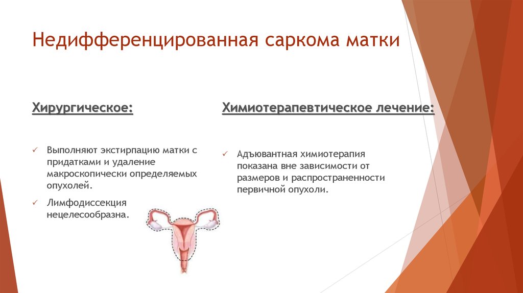 Как отличить маточное. Саркома матки классификация. Классификация сарком тела матки. Эндометриальная стромальная саркома матки.