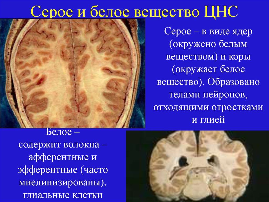 Анатомия центральной нервной системы - презентация онлайн