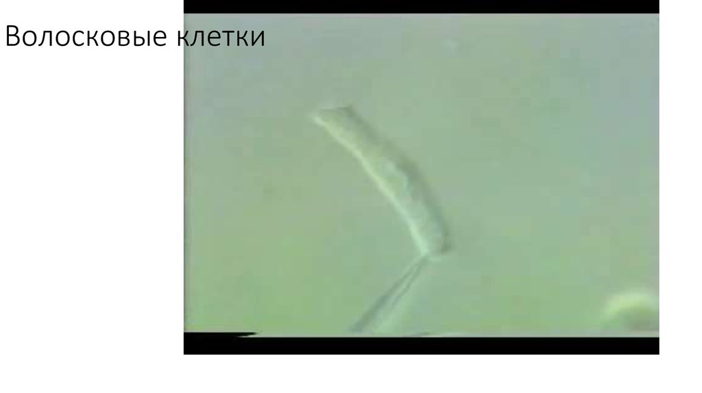 Волосковые клетки