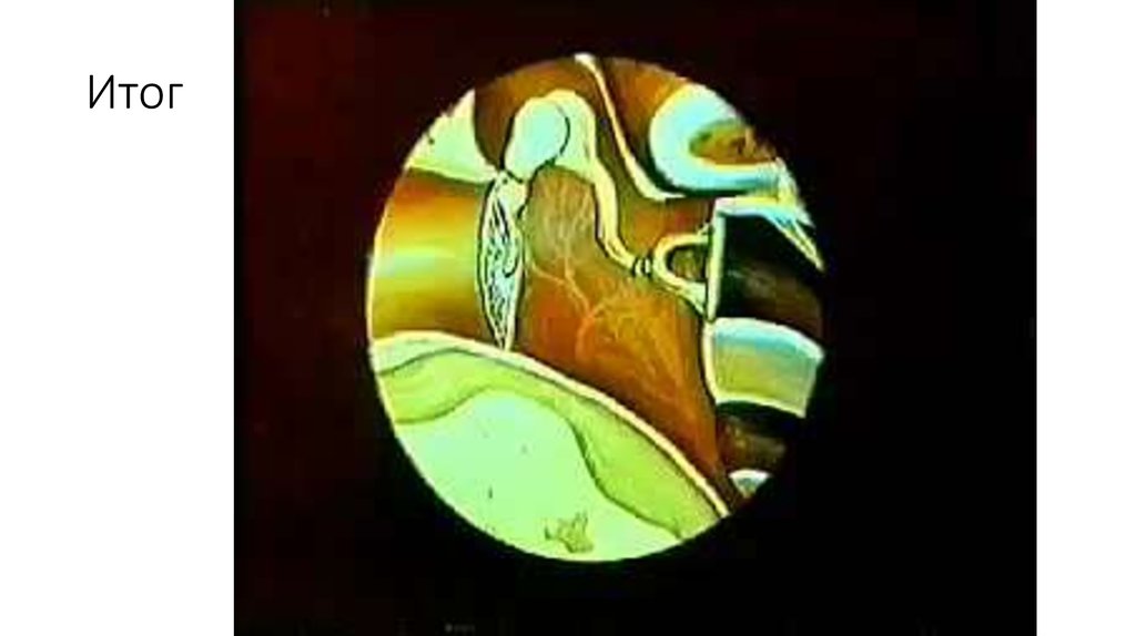 Итог