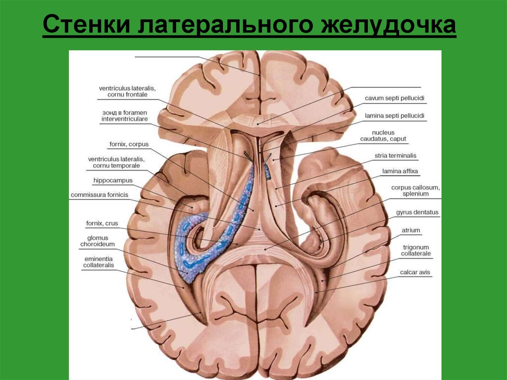 Стенка желудочка. Стенки боковых желудочков головного мозга. Стенки боковых желудочков головного мозга анатомия. Анатомия сосудистых сплетений боковых желудочков головного мозга. Коллатеральное возвышение бокового желудочка.