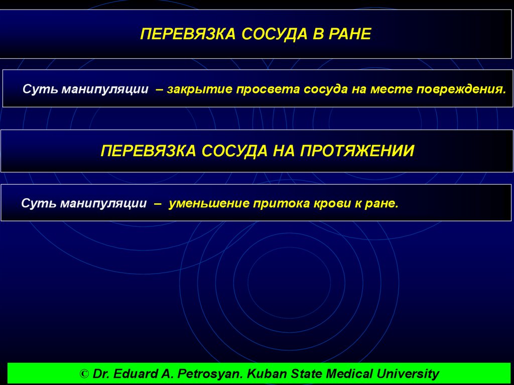 На протяжении более. Перевязка сосуда на протяжении. Перевязка кровеносного сосуда на протяжении. Перевязка артерии на протяжении. Перевязка сосуда в ране.