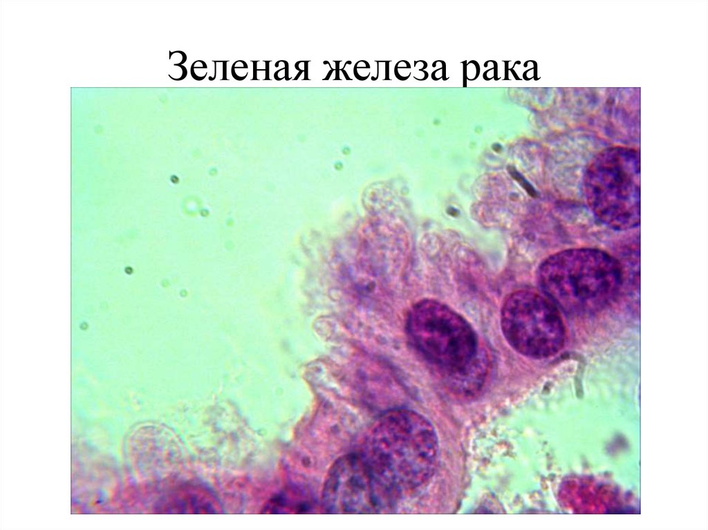 Зеленая железа. Железистый эпителий. Антеннальная (зеленая) железа речного рака.. Железистый эпителий препарат. Железистый эпителий апокриновая секреция под микроскопом. Зеленая железа под микроскопом.