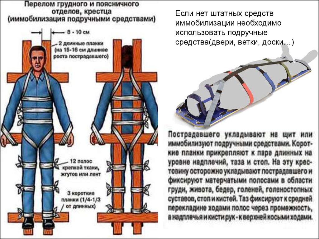 Транспортировка с переломом позвоночника каким образом. Перелом позвоночника иммобилизация. Перелом позвоночника транспортная иммобилизация. Транспортная иммобилизация при переломе позвоночника. Иммобилизация при переломе позвоночника проводится.