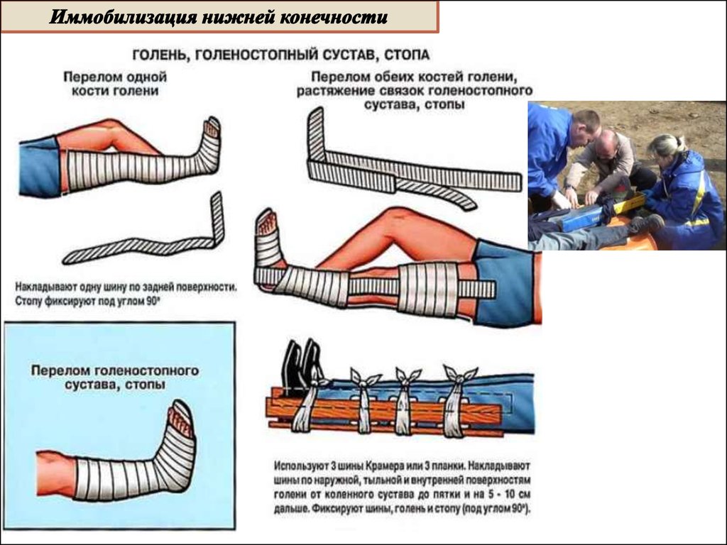 Открытый перелом голени карта вызова скорой медицинской помощи