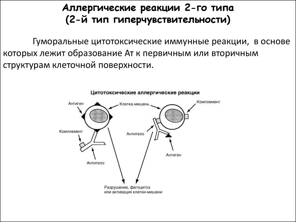 В основе реакций. Механизм развития аллергической реакции 2 типа. Патогенез аллергических реакций 2 типа. Схема аллергической реакции 2 типа. Реакция гиперчувствительности 2 типа механизм.