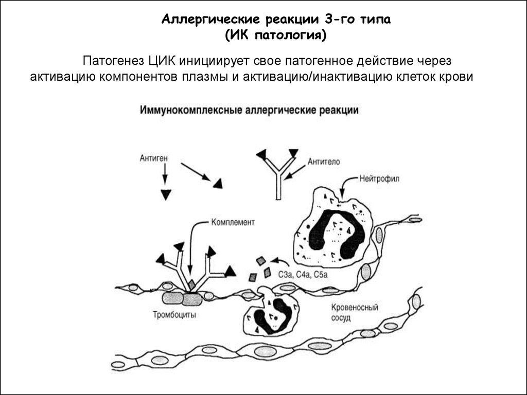 Компонент аллергической реакции. Аллергическая реакция первого типа патогенез. Схема аллергии 3 типа. Схема аллергической реакции 3 типа. Аллергическая реакция 3 типа механизм.