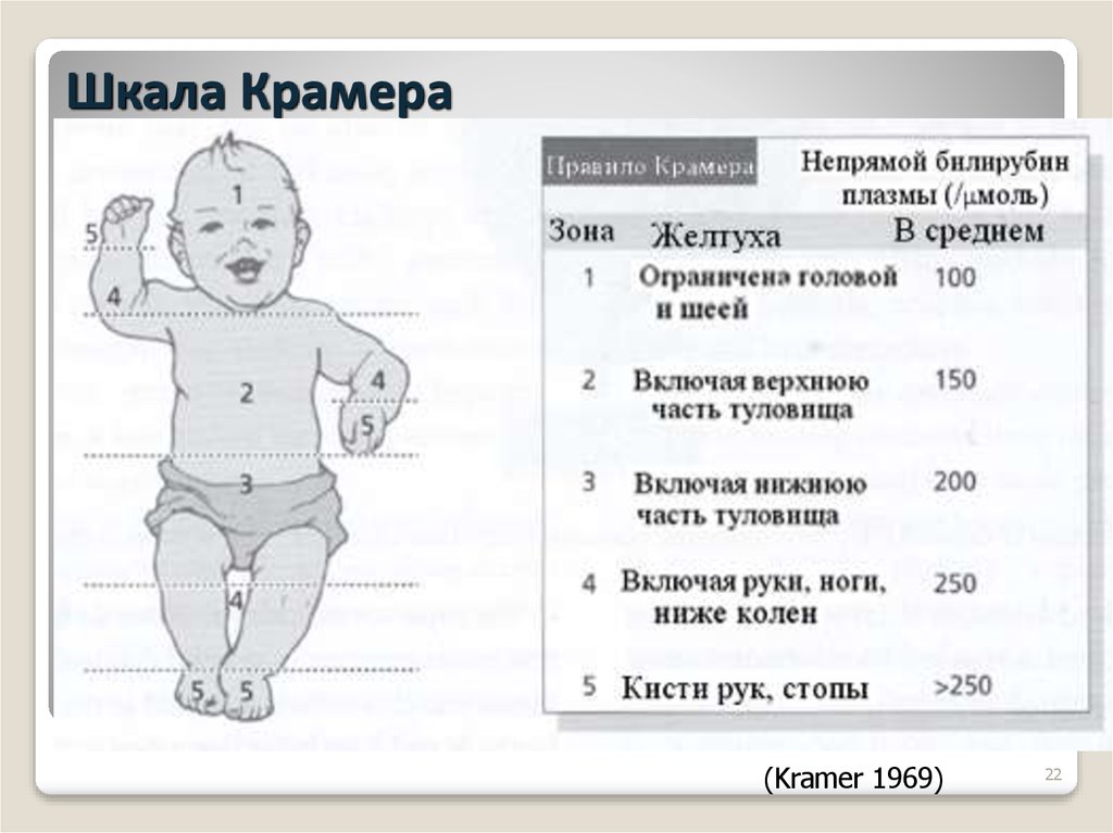 Желтушка новорожденных сколько дней. Норма уровня желтушки у новорожденных. Физиологическая желтуха у новорожденных норма. Нормы билирубина у новорожденных при физиологической желтухе. Норма билирубина у новорожденных в 1 месяц при желтушке.