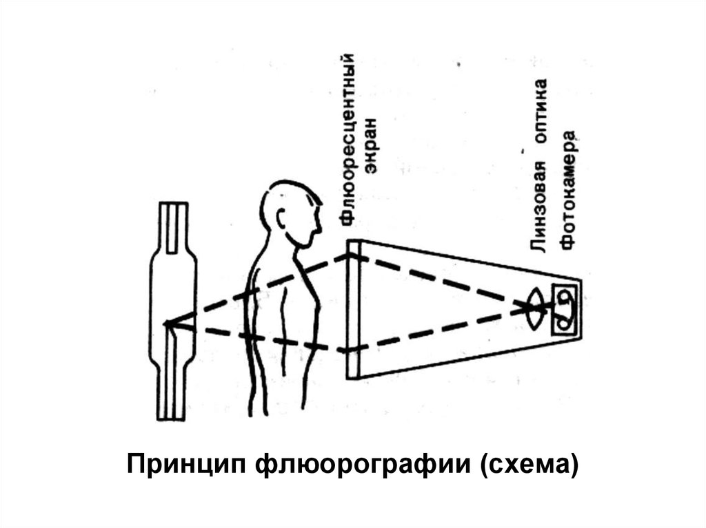 Схема работы рентгена