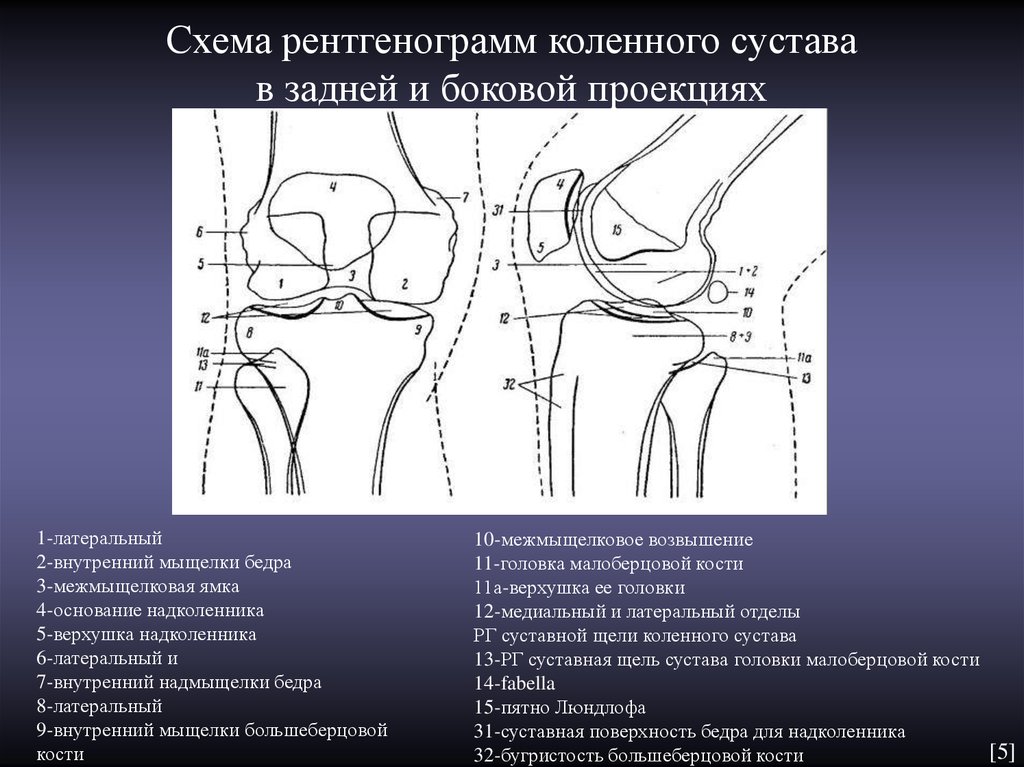 Схема рентгенограмм коленного сустава в задней и боковой проекциях