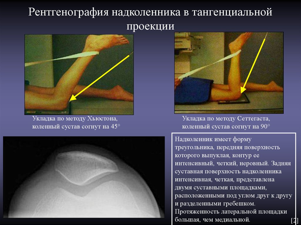 Проекции рентгенограмм. Аксиальная проекция надколенника рентген. Тангенциальная проекция надколенника. Аксиальная проекция коленного сустава. Рентгенография коленного сустава в тангенциальной проекции.
