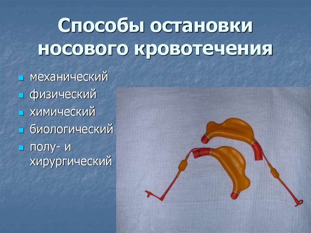 Тампонада носа при кровотечении. Остановка носового кровотечения. Способы остановки кровотечения носа. Способы остановки носового кровотечения. Методы остановки кровотечения из носа.