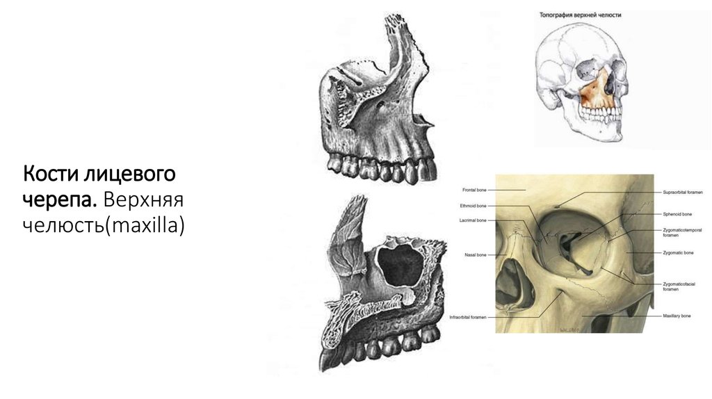 Форма костей лицевого черепа. Максила верхняя челюсть. Кости лицевого черепа.