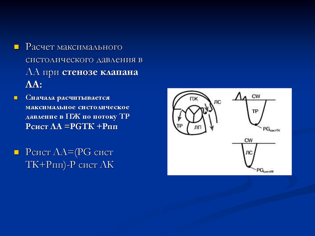 Сдла норма. Расчет систолического давления. Расчёт давления в легочной артерии при стенозе. Нормы градиентов давления на клапанах сердца. Нормальные градиенты давления на клапанах сердца.