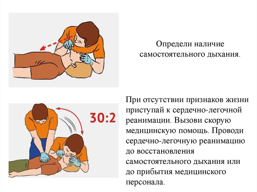 Признаки сердечно легочной реанимации. Алгоритм оказания первой помощи сердечно-легочная реанимация. Алгоритм сердечно легочной реанимации (30:2). Реанимация первая помощь алгоритм. . Алгоритм оказания первой медицинской помощи при отсутствии дыхания.