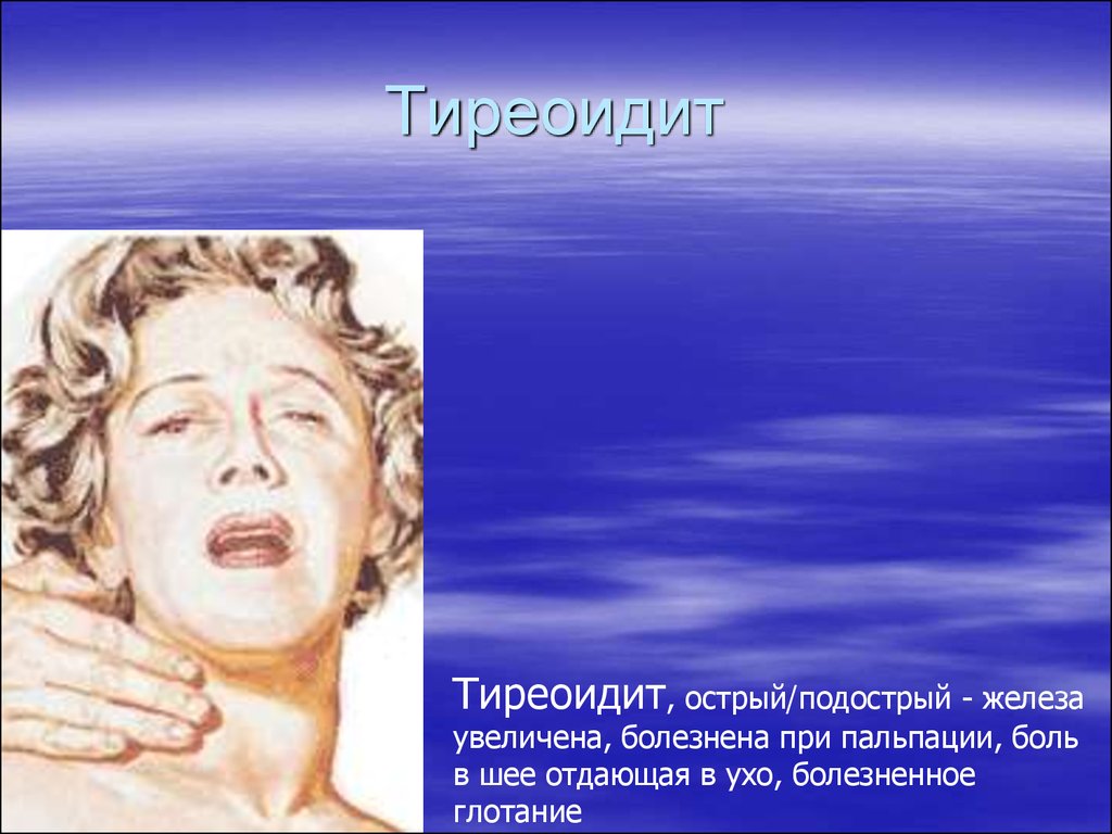 Тиреоидит. Острый и подострый тиреоидит. Подострый тиреоидит щитовидной.