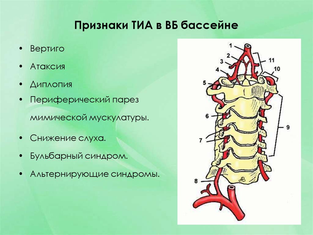 Дроп атаки. Признаки Тиа. Транзиторная ишемия. Транзиторная ишемическая атака парез.