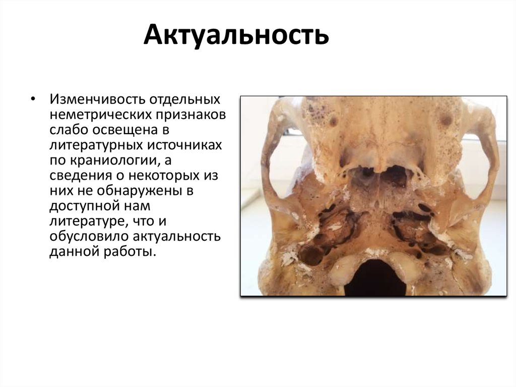 Актуальность