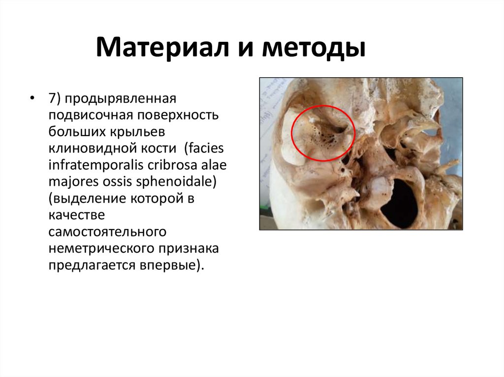 Материал и методы