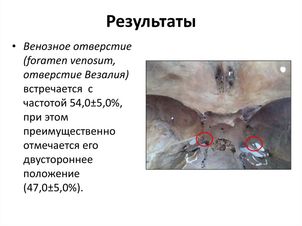 Результаты