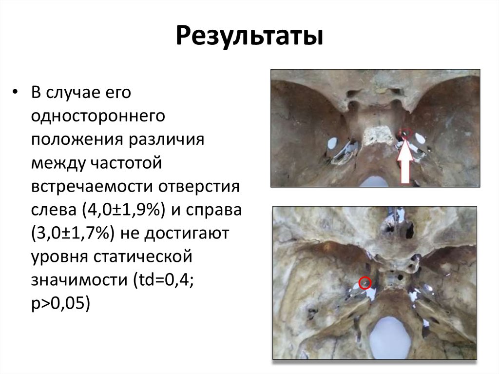 Результаты