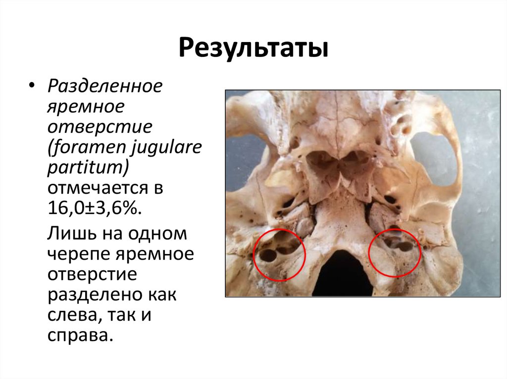 Результаты