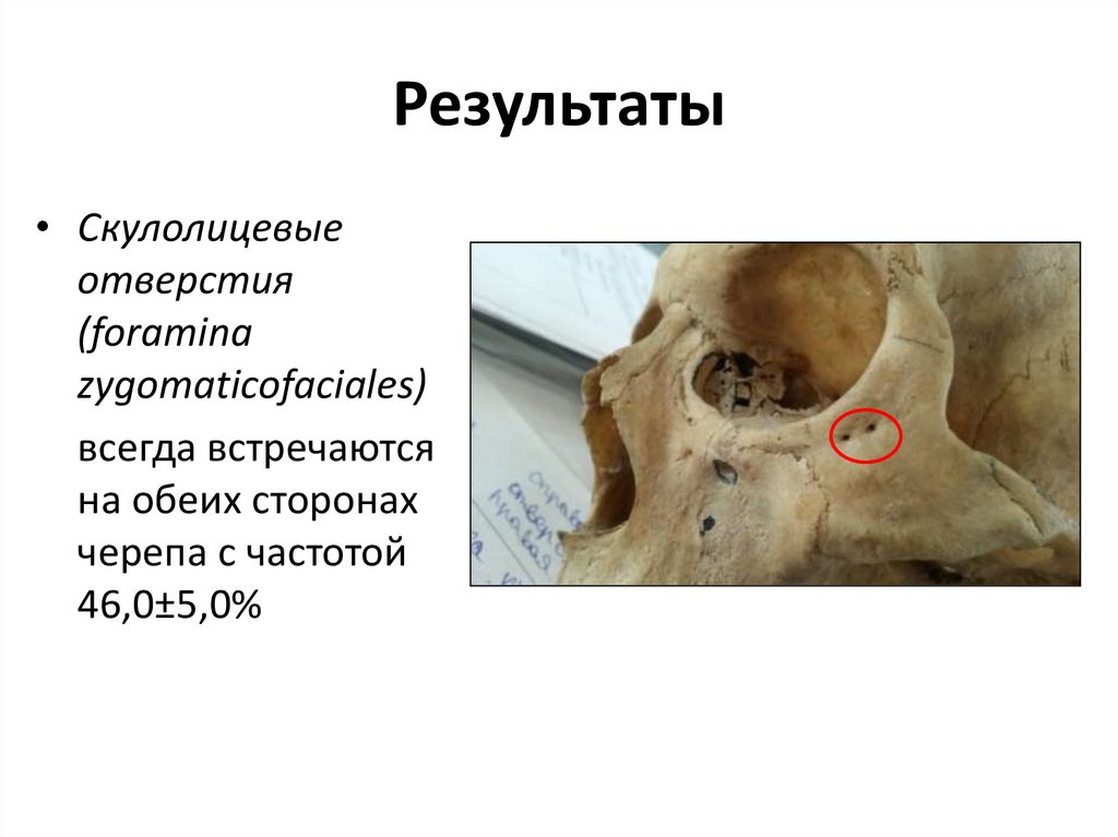 Результаты