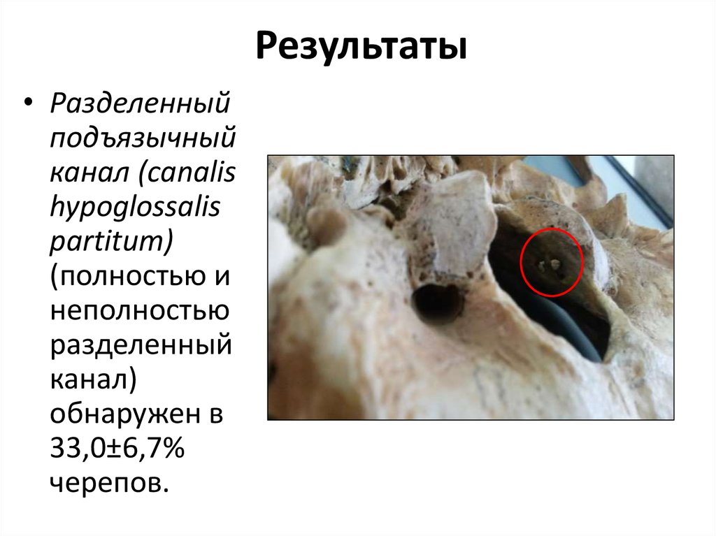 Результаты