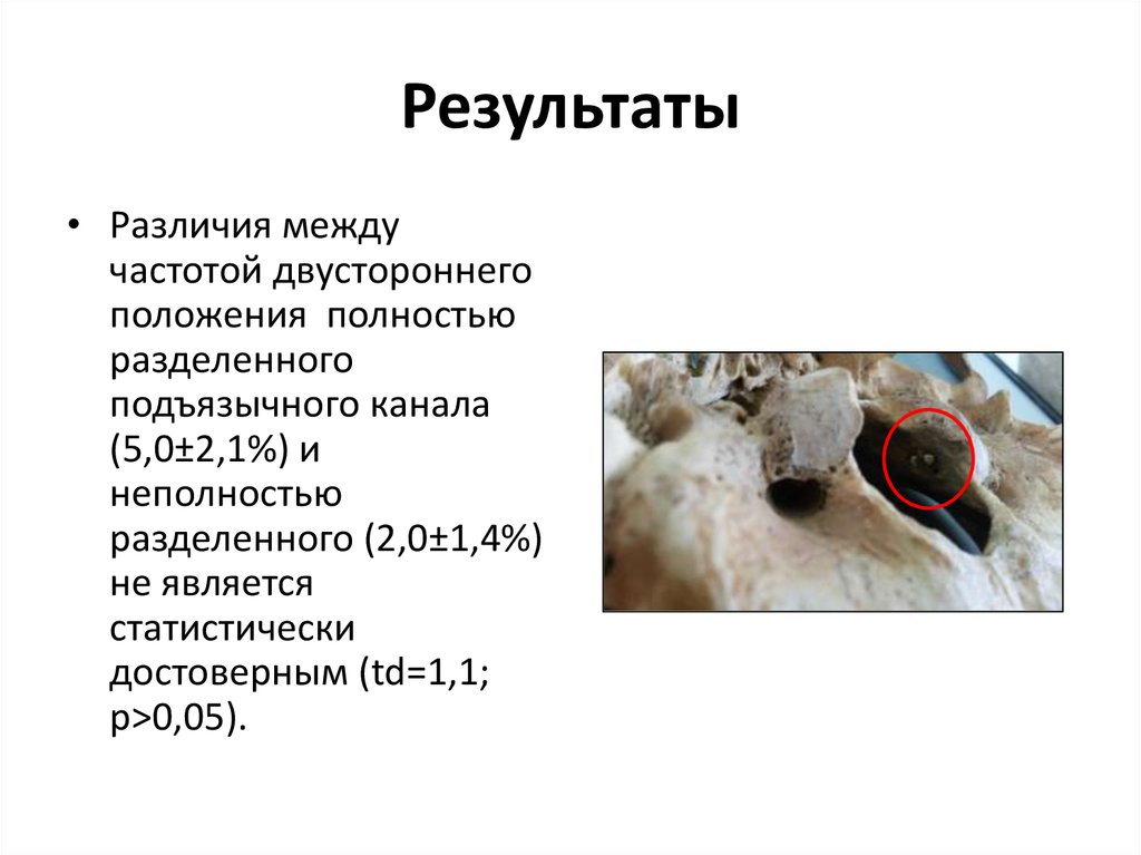 Результаты