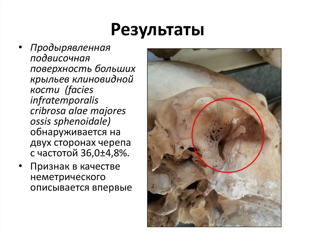 Результаты