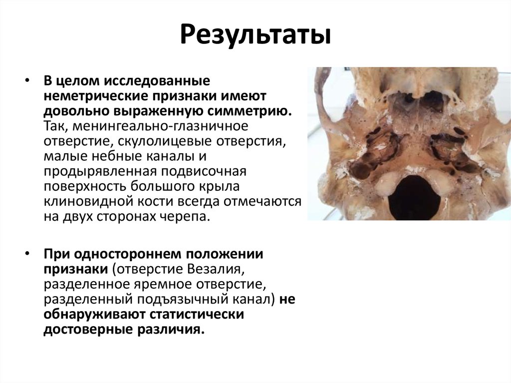 Результаты