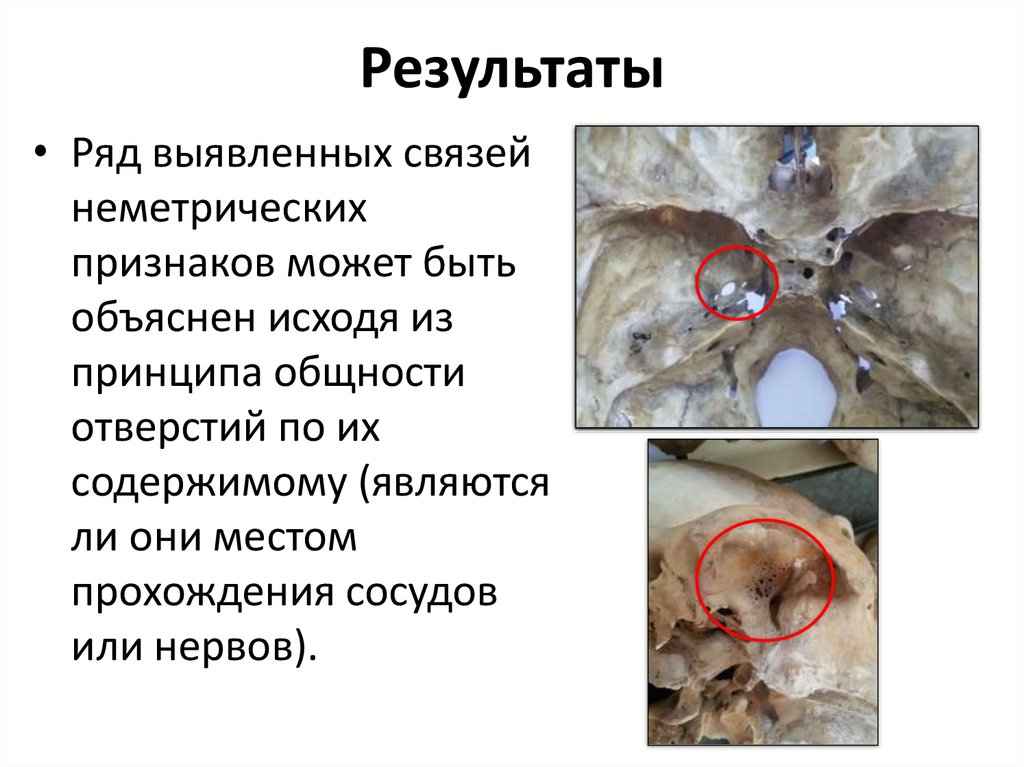 Результаты