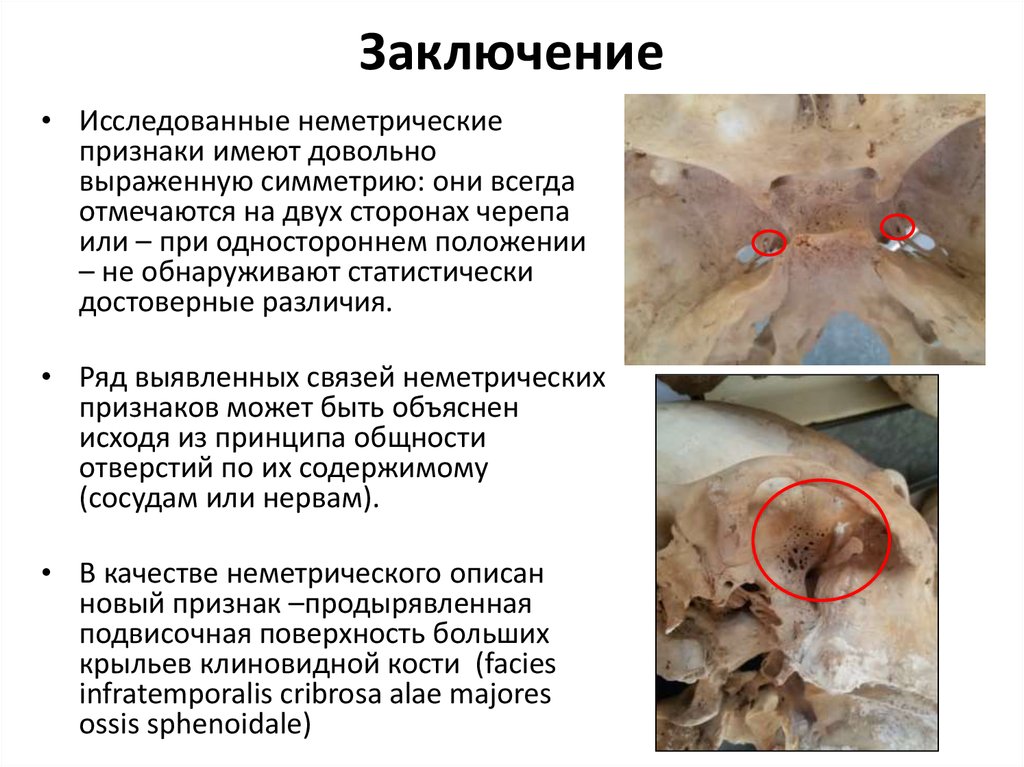 Заключение