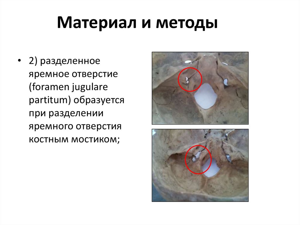 Материал и методы