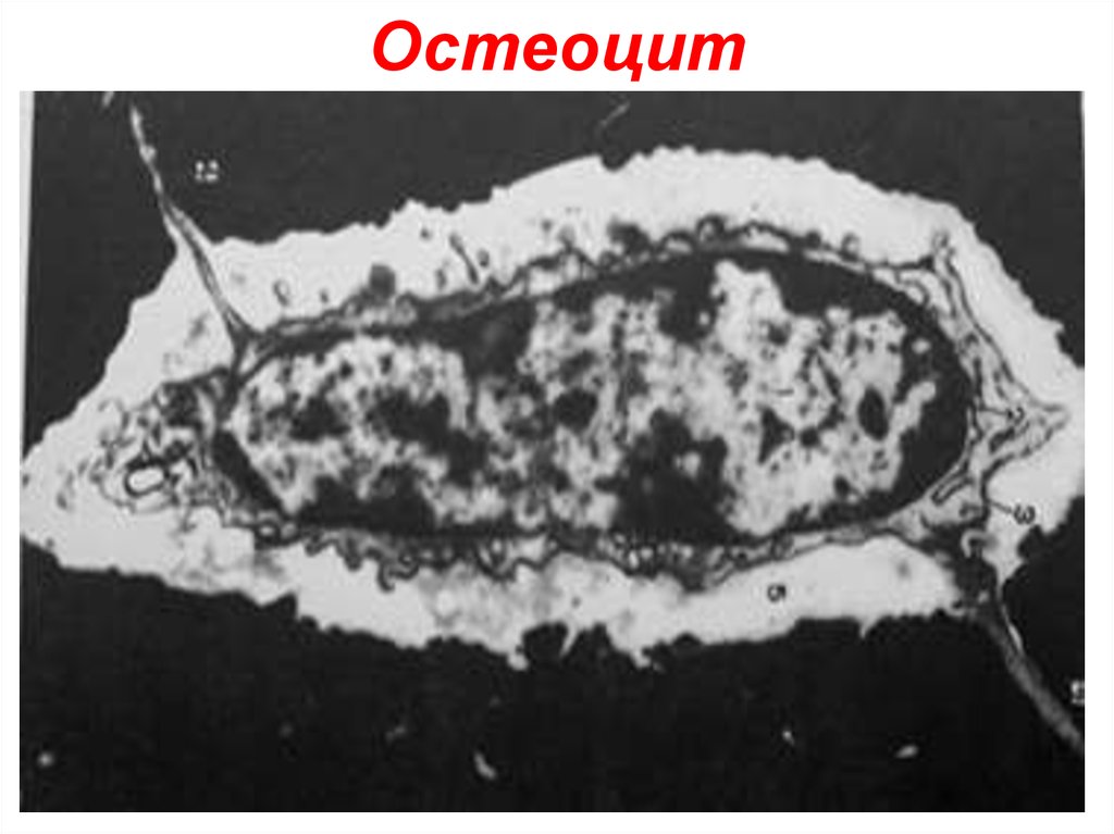 Остеоцит. Остеоцит Электронограмма. Остеоциты под микроскопом. Остеоцит фото. Остеоцит морфология.
