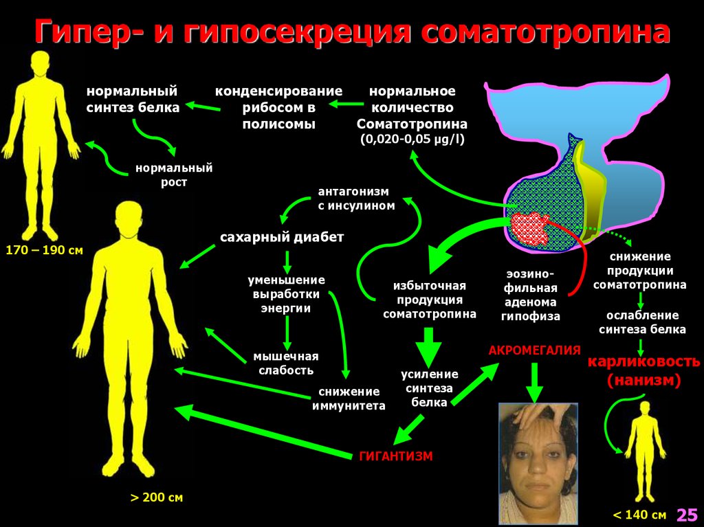 Акромегалия и гигантизм патофизиология презентация