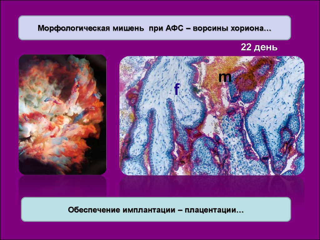 Антифосфолипидный синдром при беременности презентация