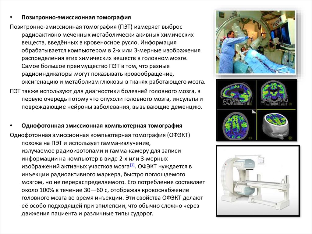 Принципы получения изображения пэт