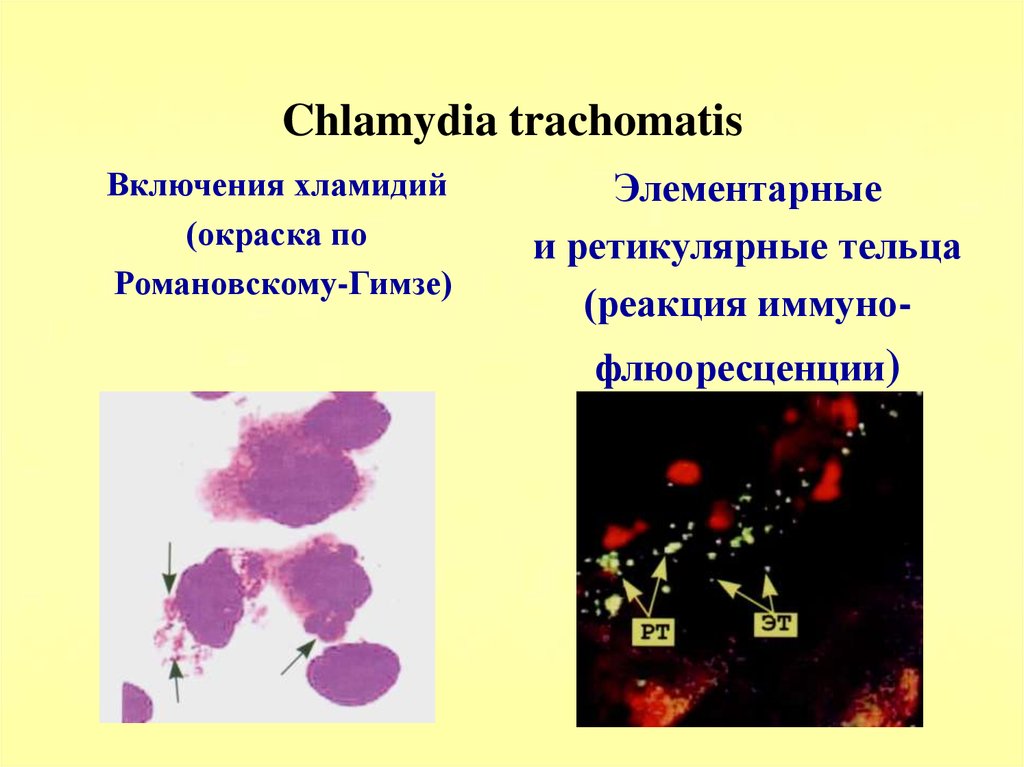 Anti chlamydia trachomatis. Хламидии Романовскому Гимзе. Chlamydia trachomatis микроскопия по Граму. Хламидия микробиология морфология. Хламидии трахоматис по Граму.