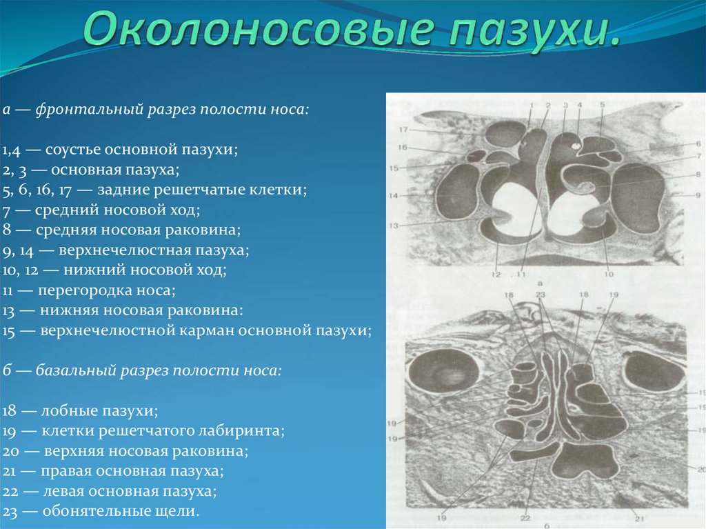 Соустье. Околоносовые пазухи животных. Околоносовые пазухи гистология. Околоносовые пазухи носа. Основная пазуха.