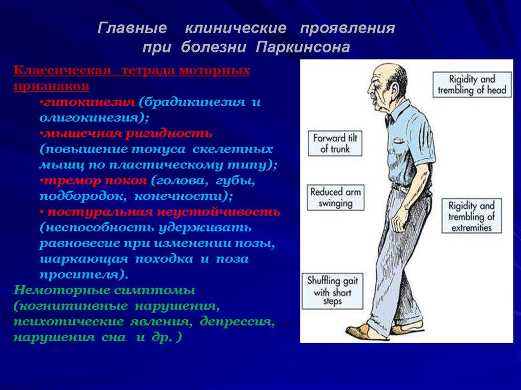 Болезнь паркинсона ног