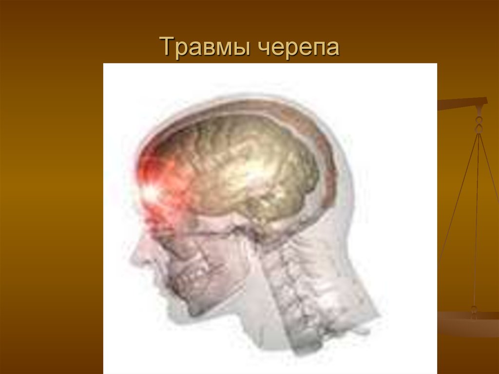 Traumatic brain injury