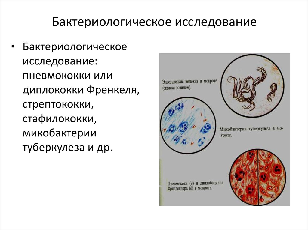 Туберкулез кокки