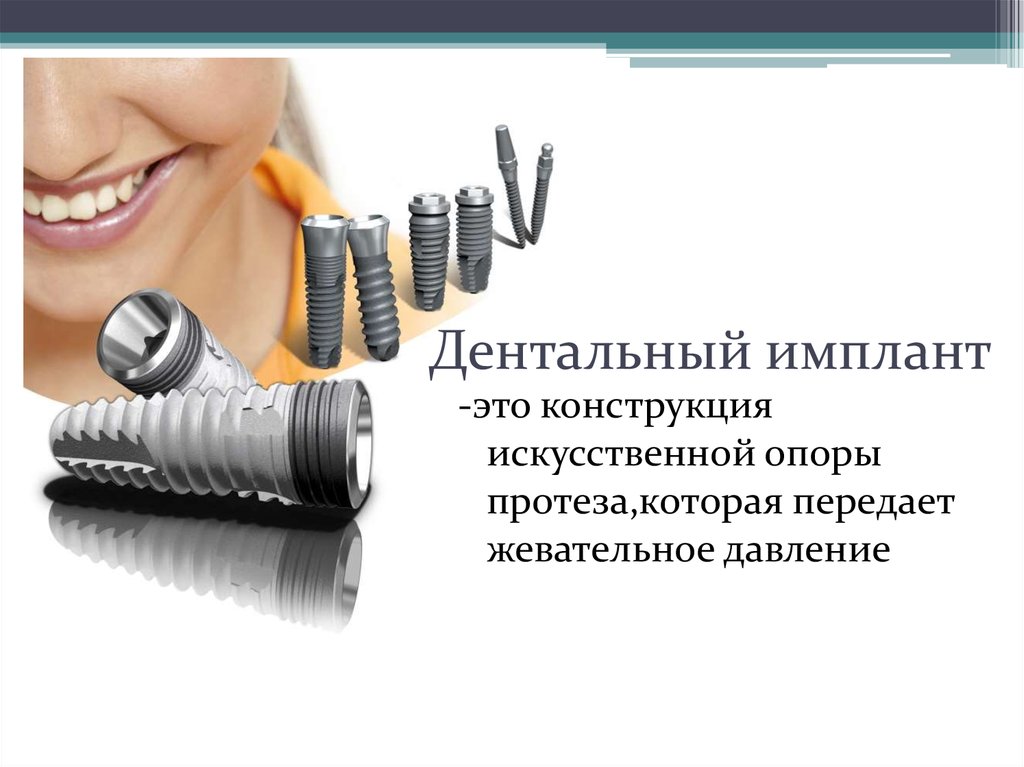 Особенности протезирования с использованием различных систем имплантатов презентация