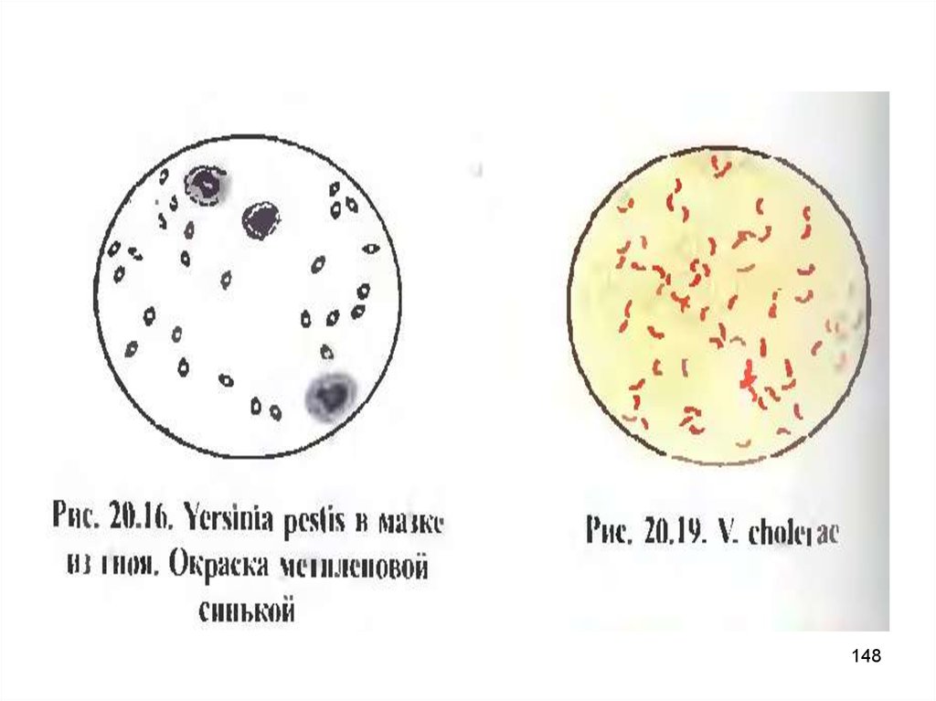 Иерсиния пестис рисунок